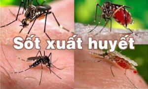 sốt xuất huyết ở hà nội 2023